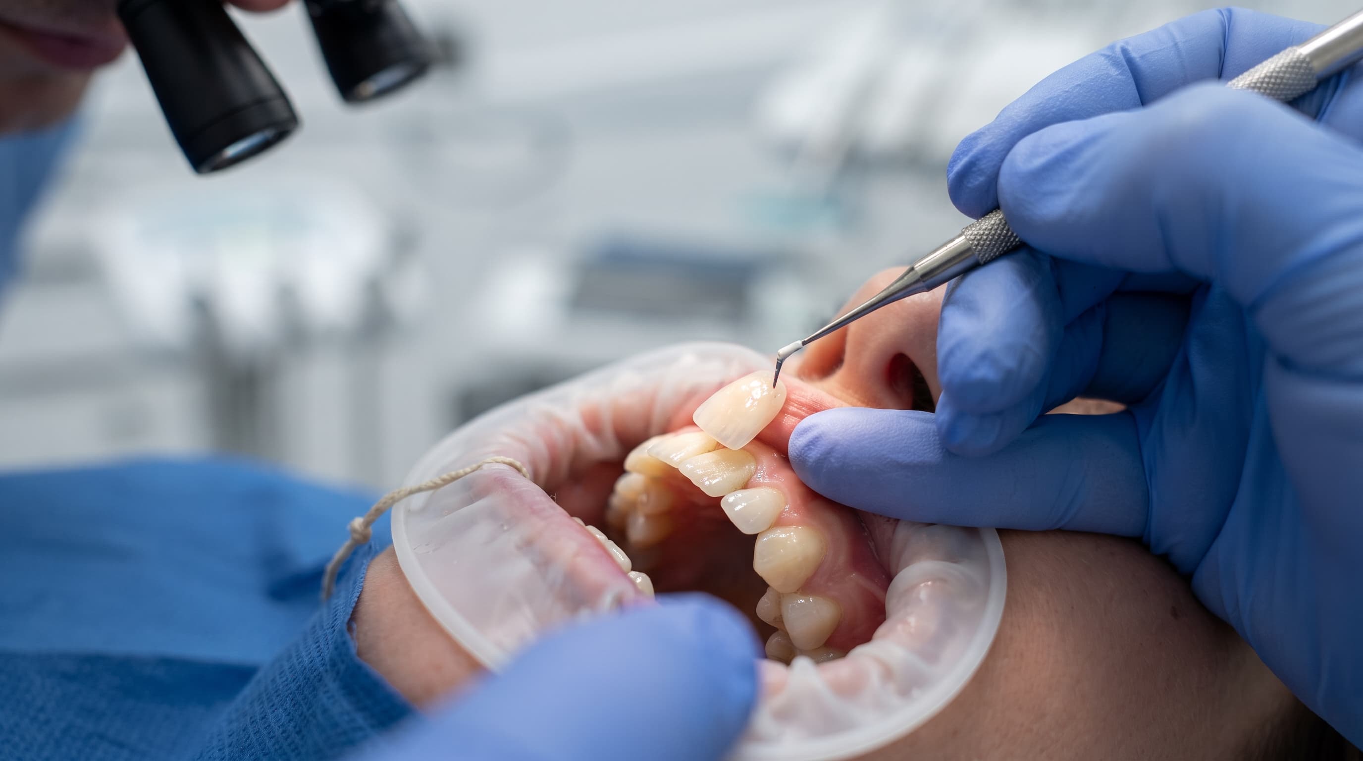 Cosmetic Dentist Solutions Designed Around Your Best Smile